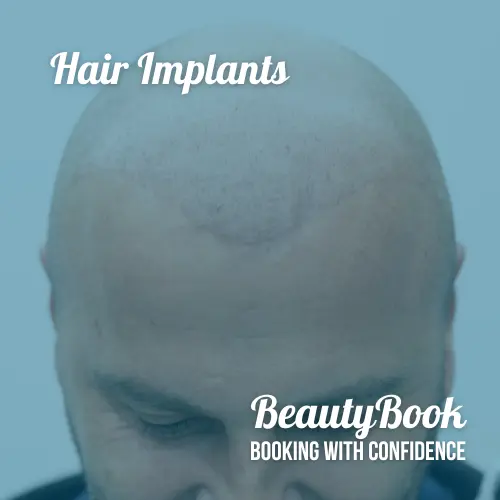 hair-implant-beautyBook