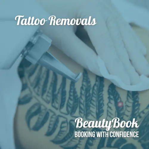 tattoo-removals-beautyBook